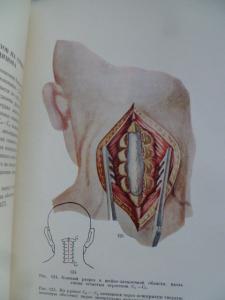  Атлас операций на спинном мозгу.